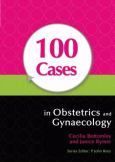 100 Cases In Obstetrics And Gynaecology
