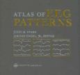 Atlas Of Eeg Patterns