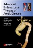 Advanced Endovascular Therapy Of Aortic Disease