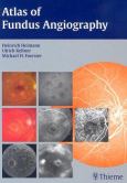 Atlas Of Fundus Angiography