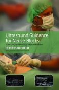 Ultrasound Guidance for Nerve Blocks: Principles and Practical Implementation