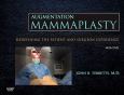 Augmentation Mammaplasty with DVD: Redefining the Patient and Surgeon Experience