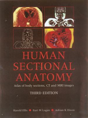 Sectional Anatomy By Mri And Ct Atlas Of Hybrid Imaging Sectional