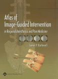 Atlas of Image-Guided Intervention in Regional Anesthesia and Pain Medicine - cover photo