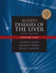 Schiff's Diseases of the Liver. 2 Volume Set