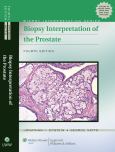 Biopsy Interpretation of the Prostate. Text with Internet Access Code for Interactive Website - cover photo