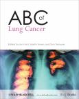 ABC of Lung Cancer - cover photo