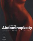 Atlas of Abdominoplasty. Text with DVD