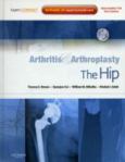 Arthritis and Arthroplasty: The Hip. Text with DVD and Internet Access Code for Expert Consult Edition
