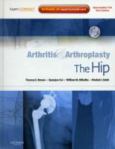 Arthritis and Arthroplasty: The Hip. Text with DVD and Internet Access Code for Expert Consult Edition - cover photo
