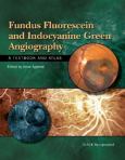 Fundus Fluorescein and Indocyanine Green Angiography: A Textbook and Atlas - cover photo