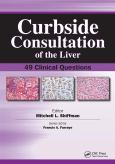 Curbside Consultation of the Liver: 49 Clinical Questions - cover photo