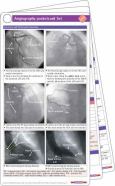 Angiography Pocketcard Set - cover photo