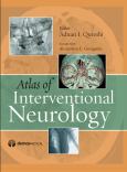 Atlas of Interventional Neurology - cover photo