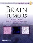 Brain Tumors - cover photo