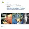 Osteotomies Around the Knee: Indications-Planning-Surgical Techniques Using Plate Fixators - cover photo