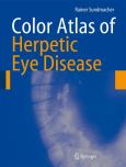 Color Atlas of Herpetic Eye Disease: A Practical Guide to Clinical Management - cover photo