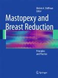 Mastopexy and Breast Reduction - cover photo